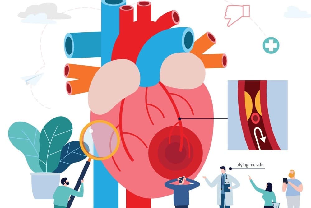 心臟衰竭致病殺手：肌間線蛋白堆積