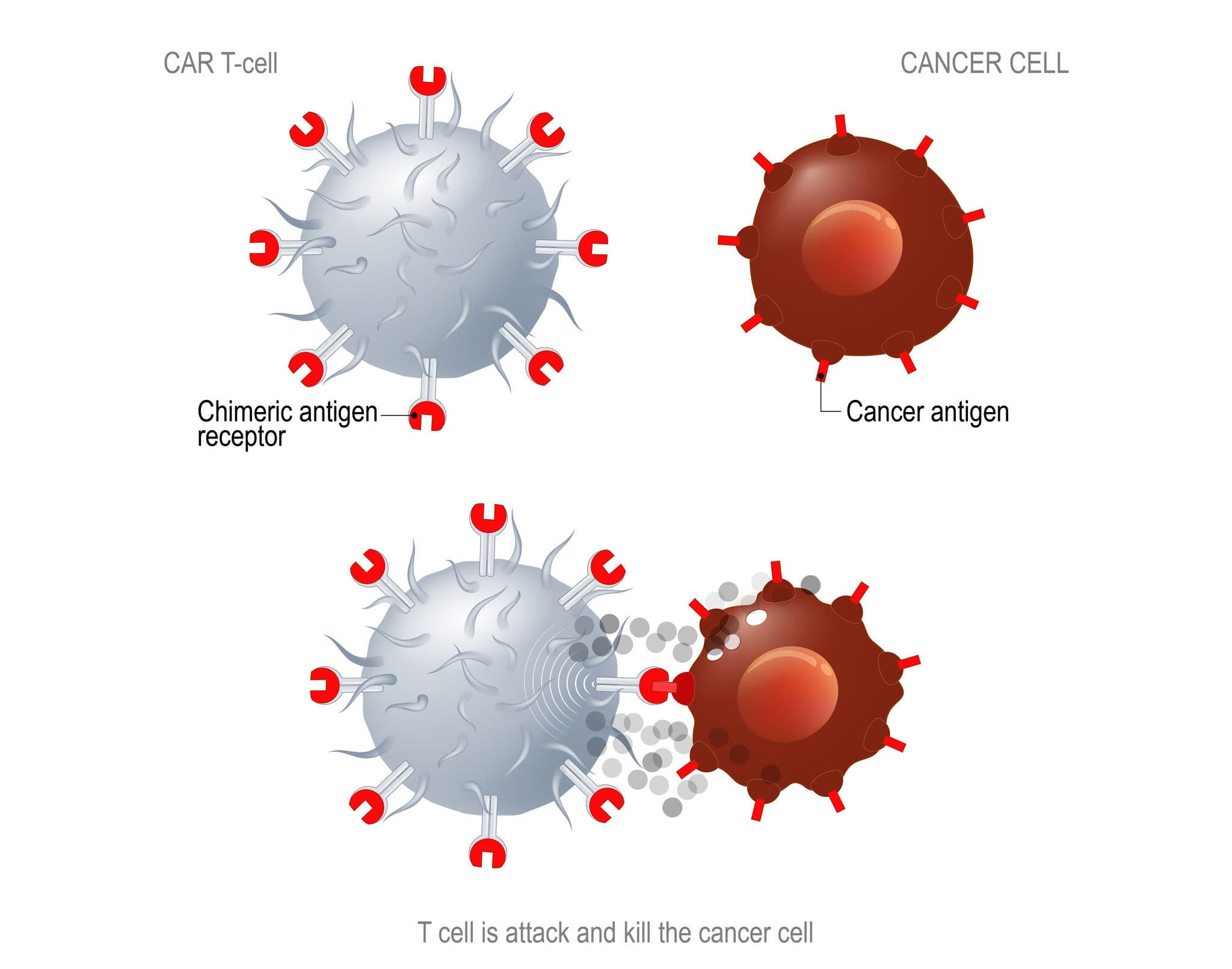 CAR-T 專利大戰！ BMS（Juno）連勝 Novartis、Gilead