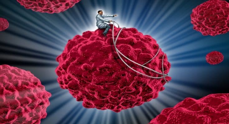 癌症免疫療法新進展：樹突細胞可望成為免疫療法的 Biomarker
