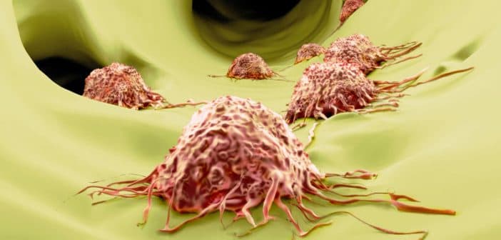 AACR 2020: Targeting the KRAS Pathway – Old Protein, New Approaches