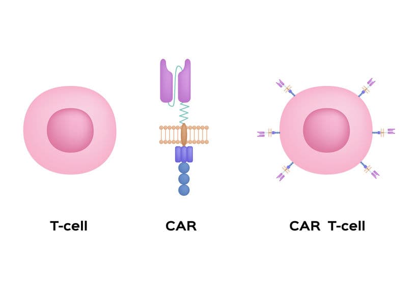 ASCO20 焦點：非基因編輯 CAR-T 抗直腸癌？腫瘤反應評估佳