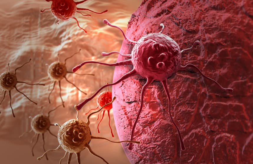 tumor-cancer