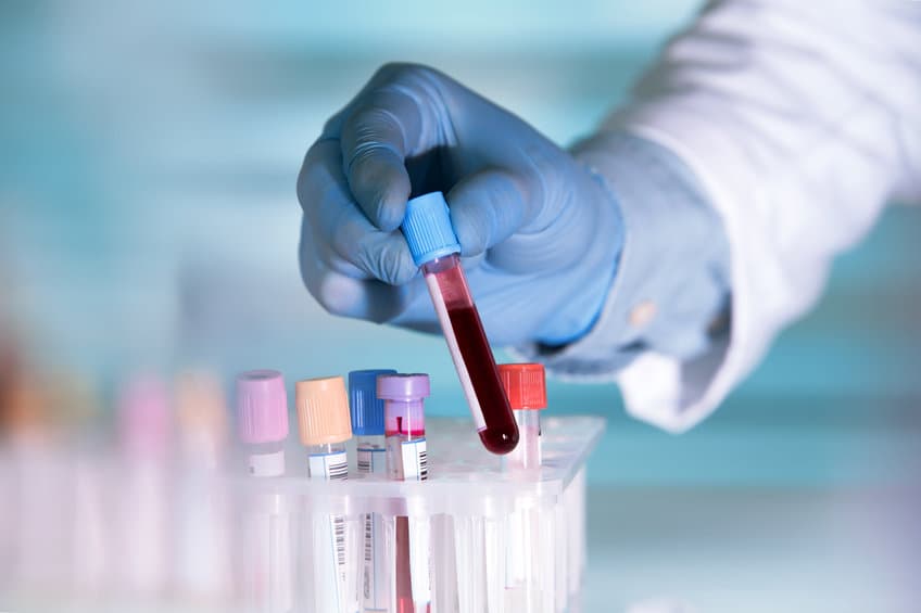 美研究分析大型臨床數據，發現 HIV 患者在感染新冠肺炎的風險較高？