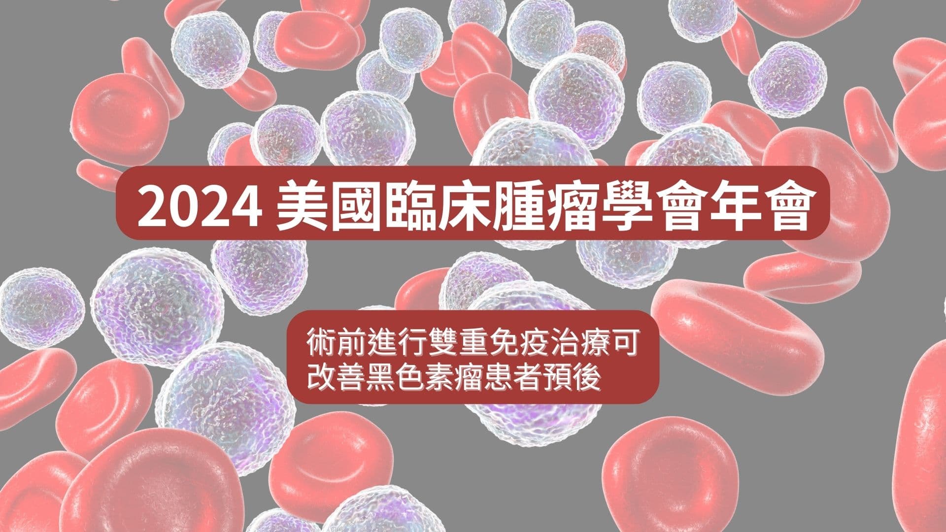 ASCO 2024 系列：術前進行雙重免疫治療可改善黑色素瘤患者預後